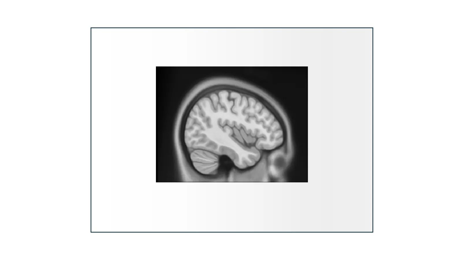 brain MRI 