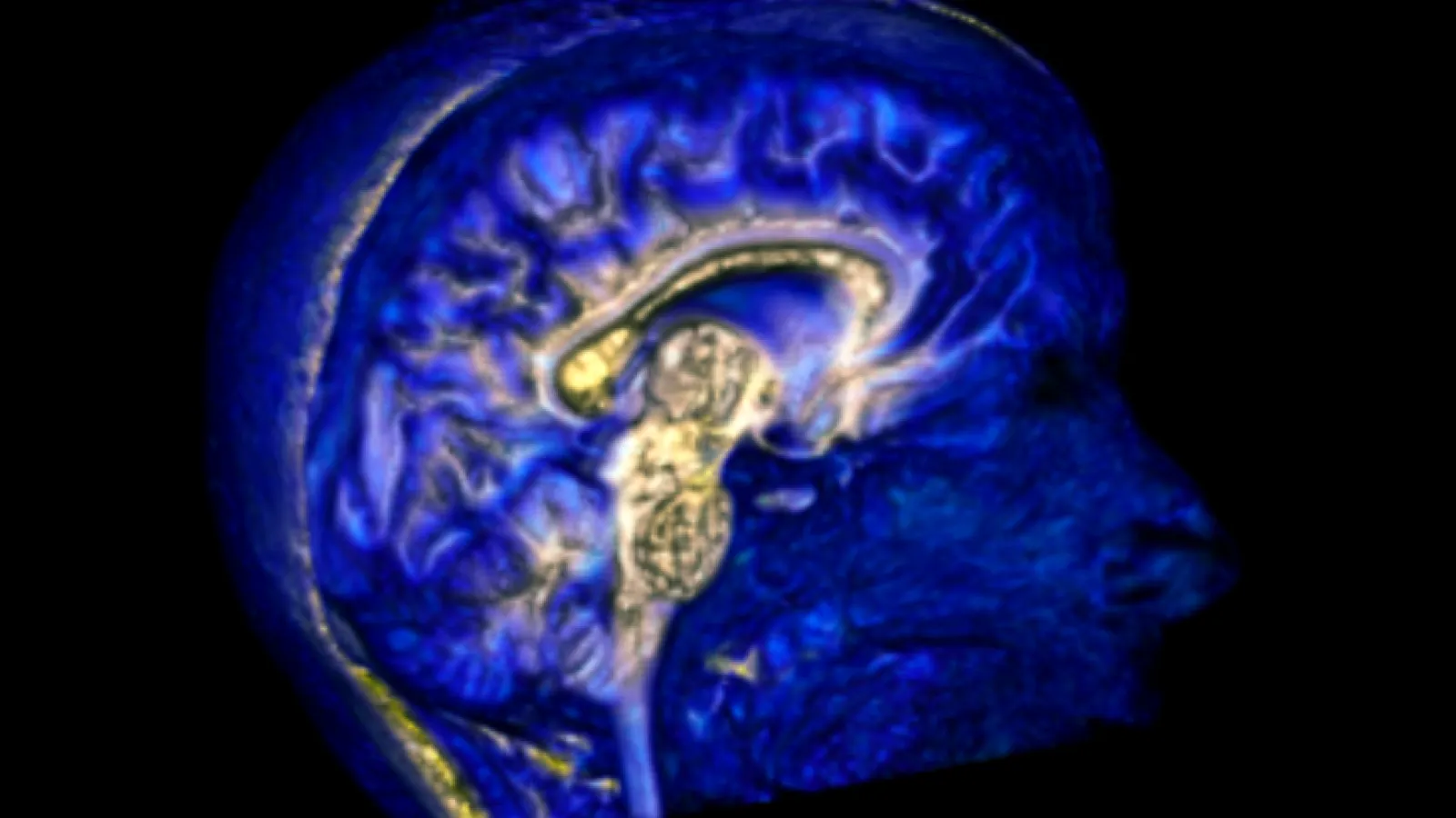 CCBBI brain imaging