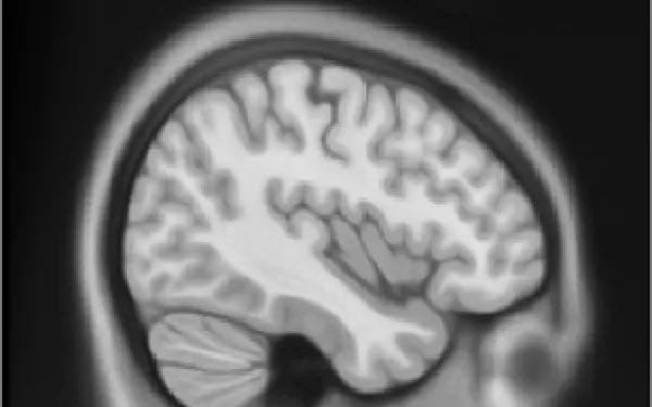 magnetic resonance image of the brain