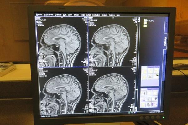 Brain imaging using the upgraded CCBBI