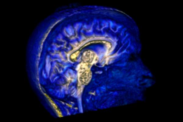 CCBBI brain imaging