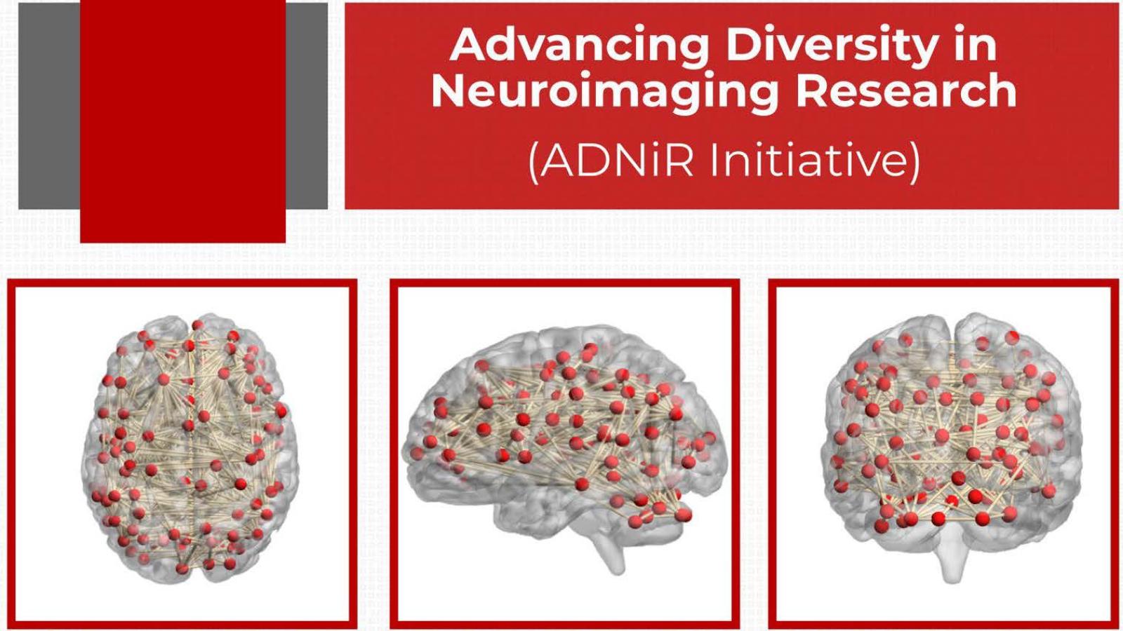 Diagram showing connections among different regions of the brain