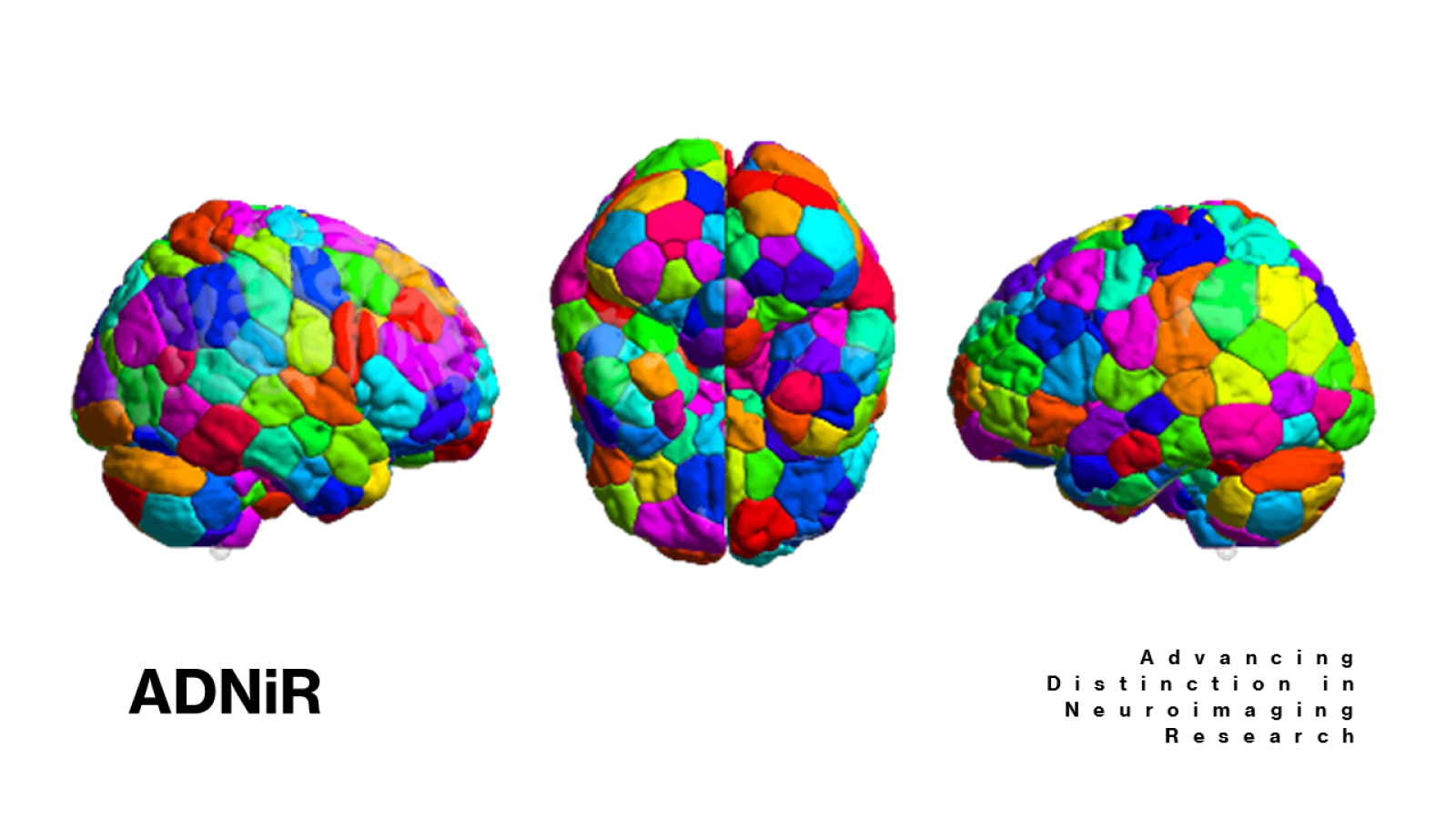 Multicolor brains