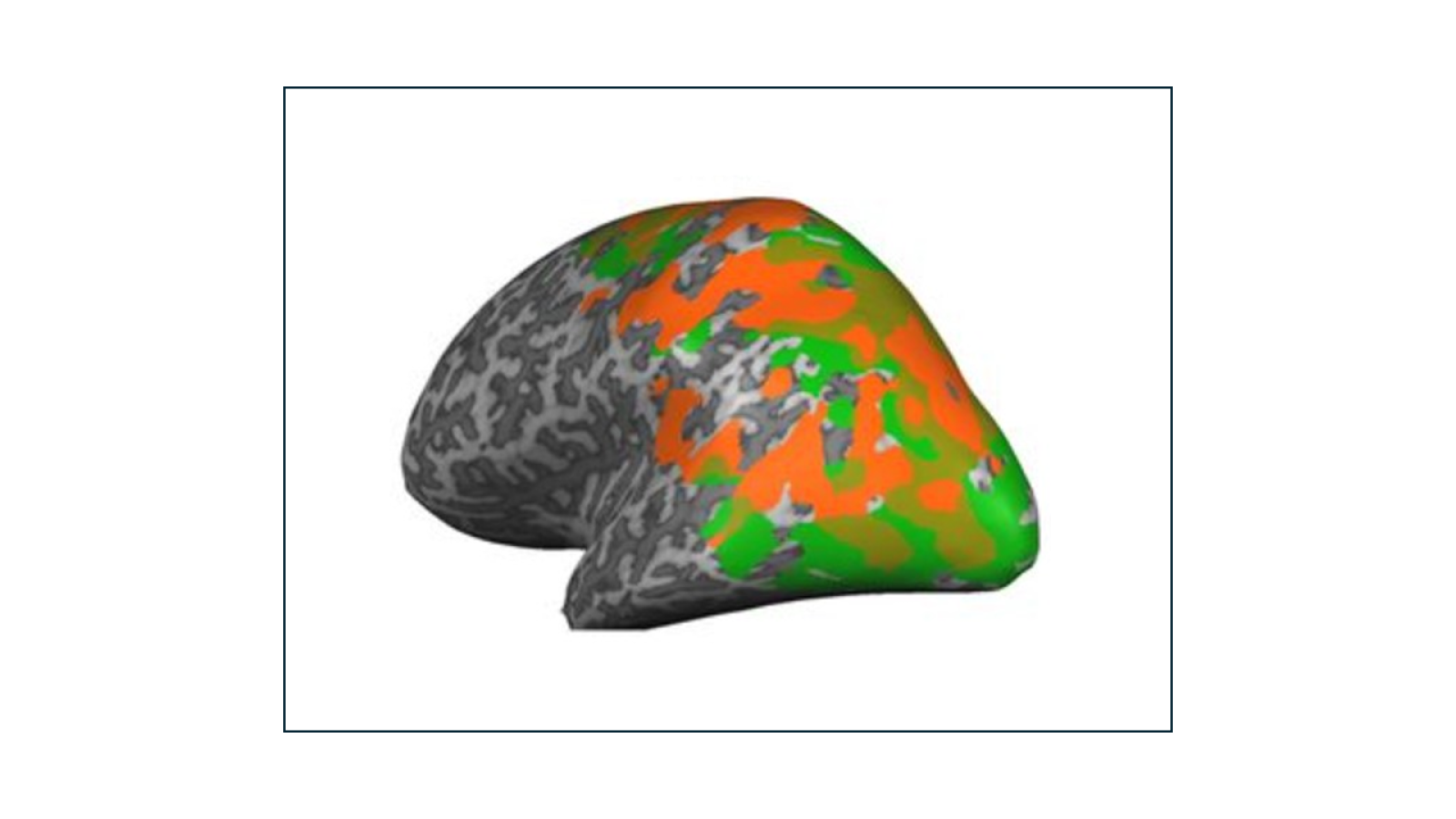 Areas of the brain that respond to shifts in attention are highlighted in green and orange.
