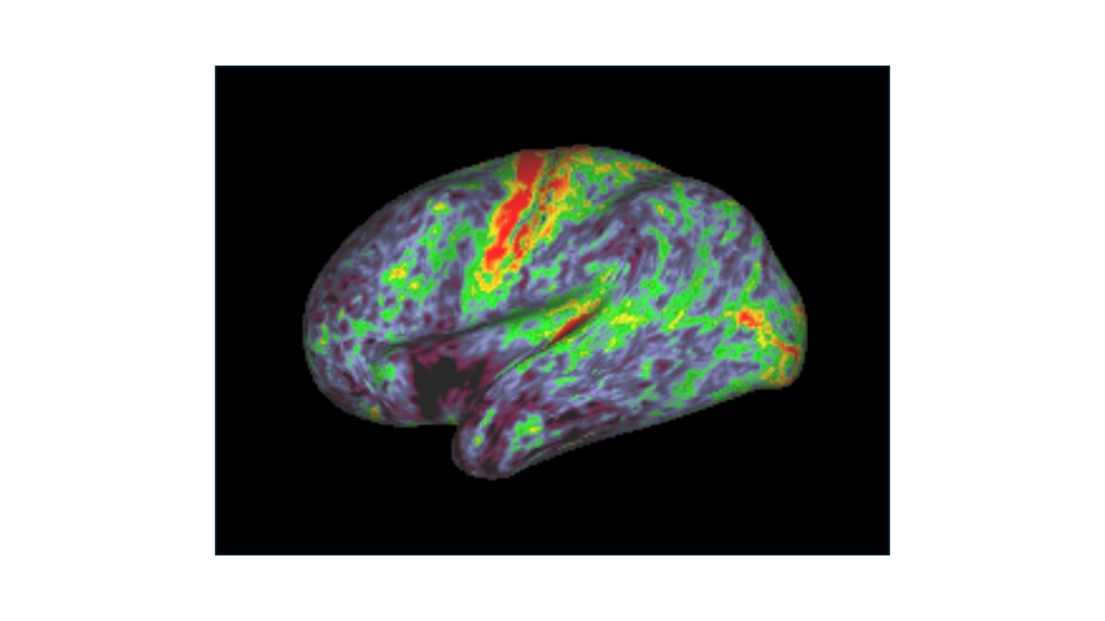 Myelin content in the brain highlighted in red and green