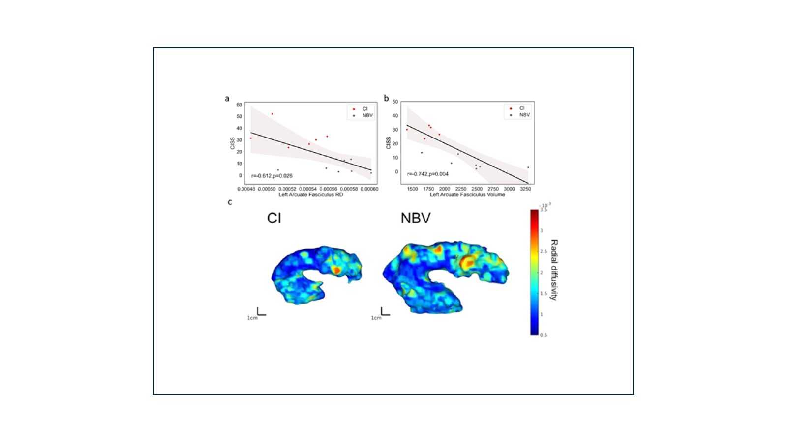 The size of the arcuate fasciculus are smaller in people of symptomatic convergence insufficiency.