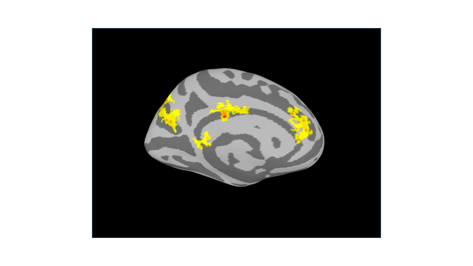 Areas of the brain's value network are highlighted in yellow