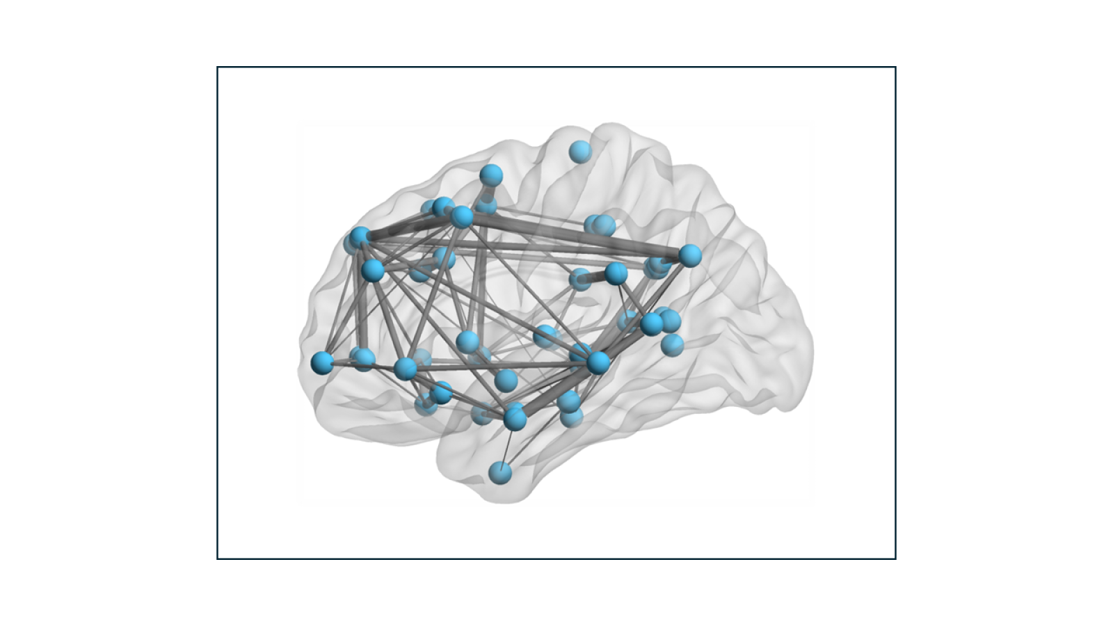 ball and stick representation of the allostatic interoceptive network in the brain