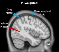 brain with different components labeled